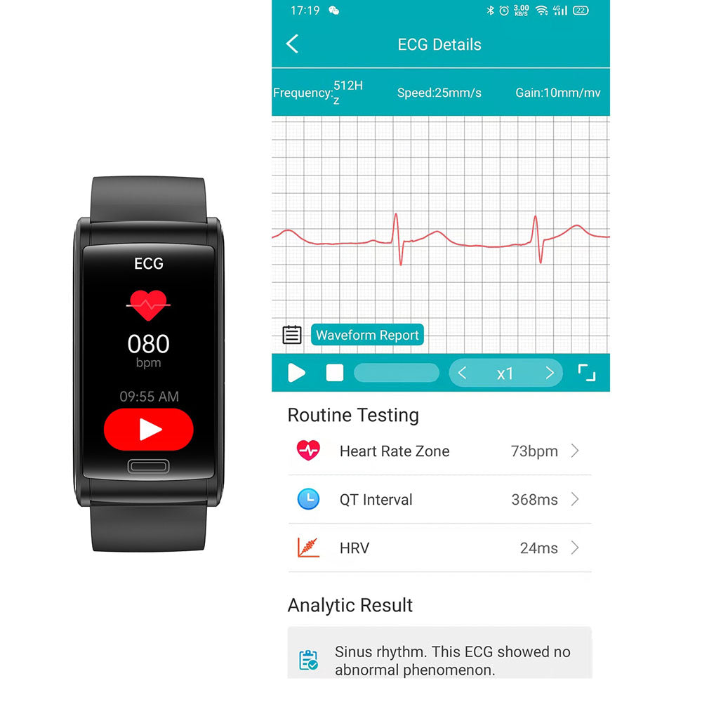 Gezondheidsarmband - BioTrack - 3-Kanaals ECG & Bloedmonitoring - Slim & Uitgebreid