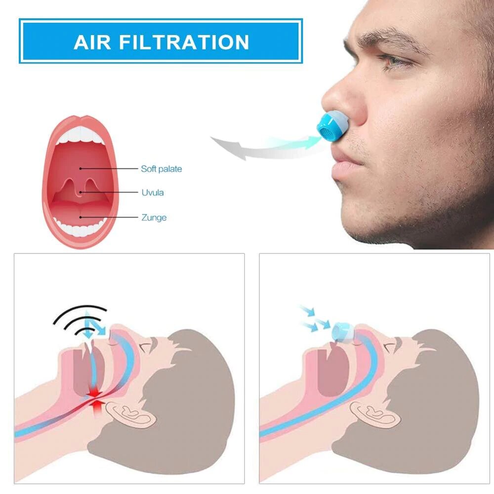 Snurktoestel - SilentBreeze - Slang- en Maskervrije Micro CPAP - Innovatieve Slaapoplossing